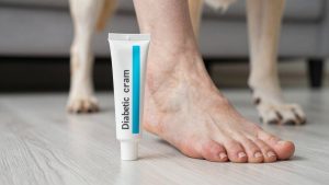 Best Diabetic Foot Creams for Dry, Cracked Heels